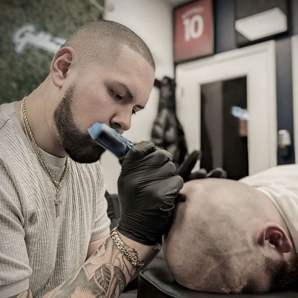 scalp micropigmentation procedure on man